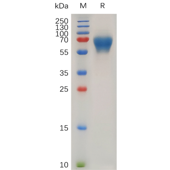 Human TM4SF1 (31-49) Protein, hFc Tag