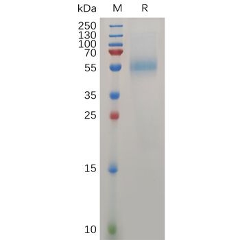 Human IL18 Protein, hFc Tag
