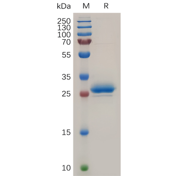 Human DKK2 Protein, hFc Tag