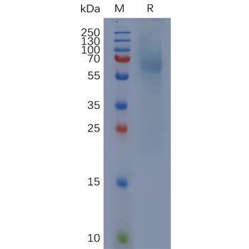 Human KRAS Protein, hFc Tag