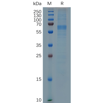 Human LGALS1 Protein, hFc Tag