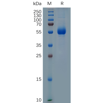 Human GAST Protein, hFc Tag