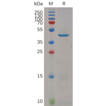 Human CCR2 Protein, hFc Tag