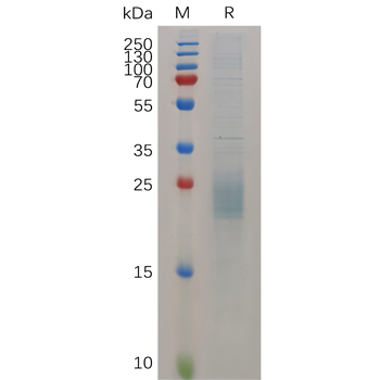 Human CB2 Protein, hFc Tag