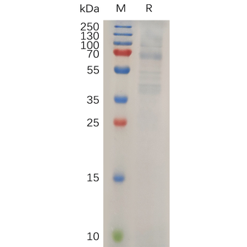 Human ADAM9 Protein, His Tag