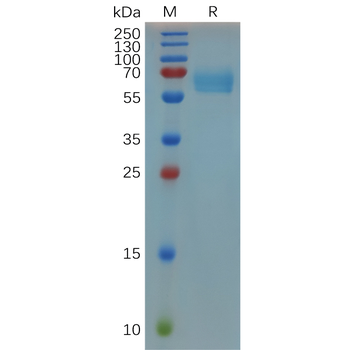 Human Nectin-4 Protein, His Tag