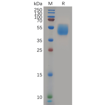 Human CD9 Protein, His Tag