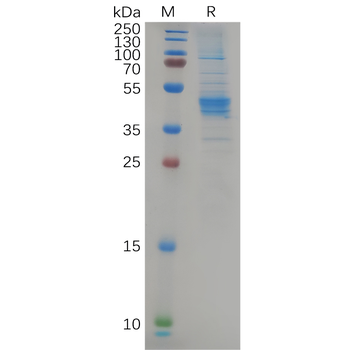 Human CD99 Protein, hFc Tag