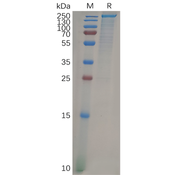 Human CXCR3 Protein, hFc Tag