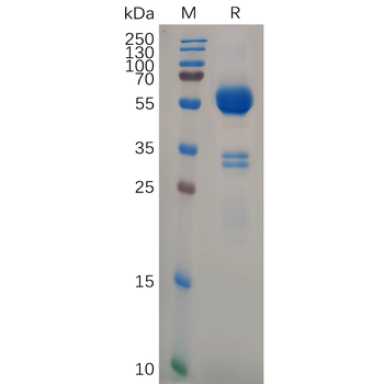 Human CD73 Protein, hFc Tag