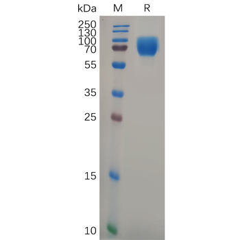 Human CCR9 Protein, hFc Tag