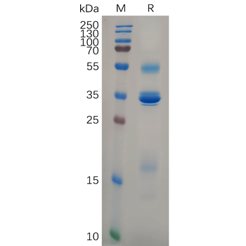 Human CCR7 Protein, hFc Tag