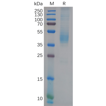 Human IGF-1R Protein, His Tag
