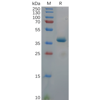 Human CD21 Protein, hFc Tag