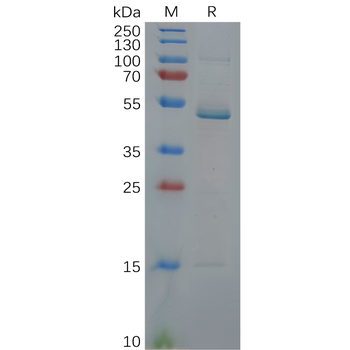 Human ANPEP Protein, His Tag