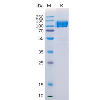 Human PGLYRP1 Protein, hFc Tag