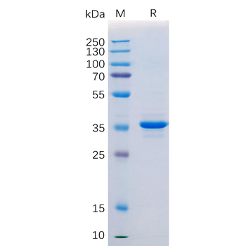 Human CDH1 Protein, mFc Tag
