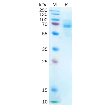 Human LAMA4 Protein, His Tag