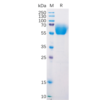 Human VWF (23-2813) Protein, His Tag
