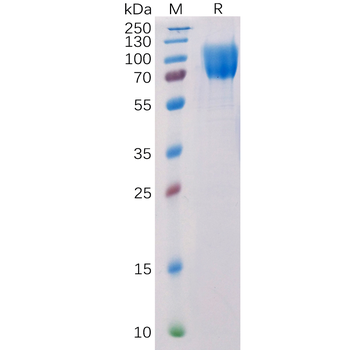 Human VWF (764-2813) Protein, His Tag