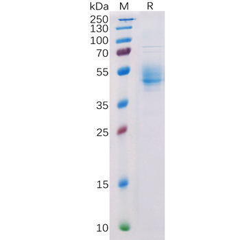 Human RNASE4 Protein, hFc Tag