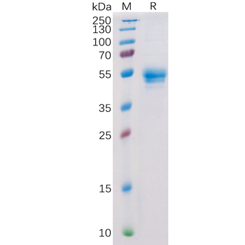 Human RNASE4 Protein, His Tag