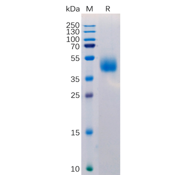 Human GPRC5D Protein, hFc Tag