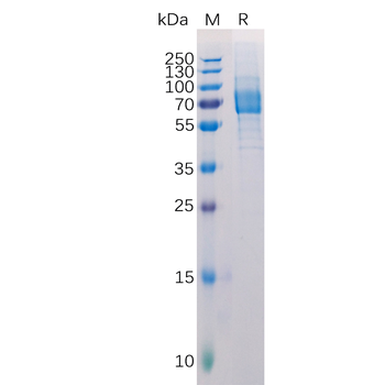 Human SLC4A7 Protein, His Tag