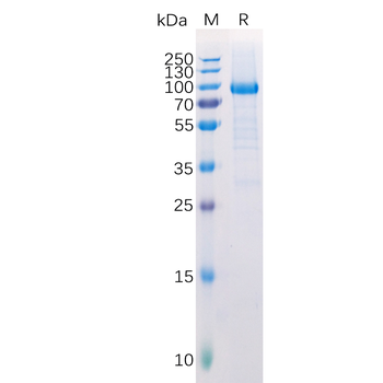 Human MMP14 Protein, hFc Tag