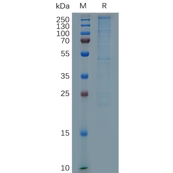 Human GPR77 (1-38) Protein, hFc Tag