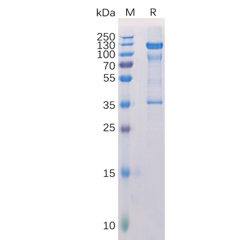 Human GFAP (68-377) Protein, His Tag