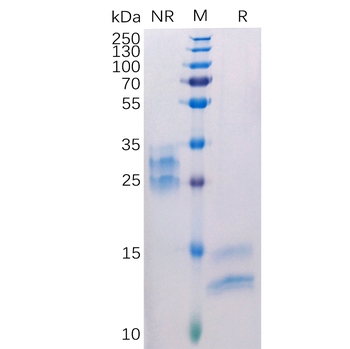 Human KCNK9 Protein, hFc Tag