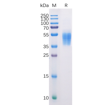 Human GPR87 Protein, hFc Tag