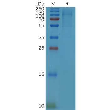 Human CCR6 Protein, hFc Tag