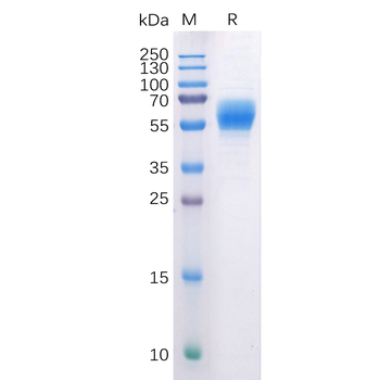 Human NEFL Protein, hFc Tag