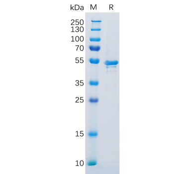 Human NEFL (9-88) Protein, hFc Tag