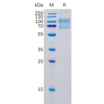 Human KRAS Protein, His Tag
