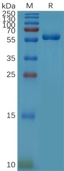 Human NEFL (89-400) Protein, His Tag