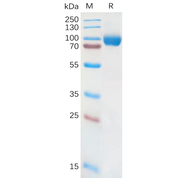 Human ROR1 (312-391) Protein, hFc Tag