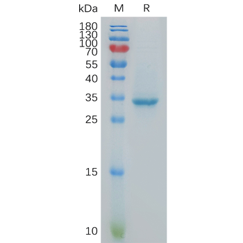 Human UCHL1 Protein, hFc Tag