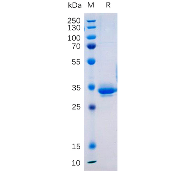 Human ADGRE1 Protein, His Tag