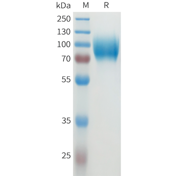 Human GFRA3 Protein, His Tag
