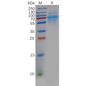 Human DLL3 Protein, hFc Tag