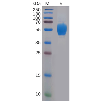 Human CD83 Protein, hFc Tag