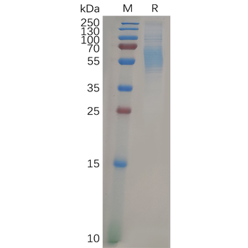 Human ALB Protein, His Tag