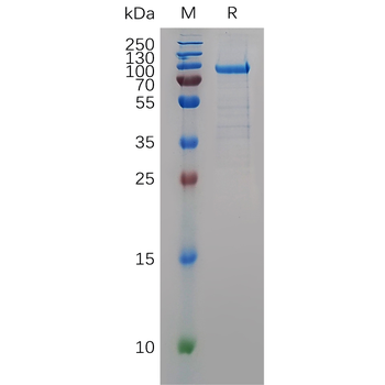 Human TLR3 Protein, His Tag