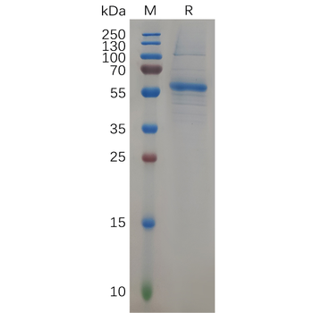 Human SLC7A11 Protein, hFc Tag