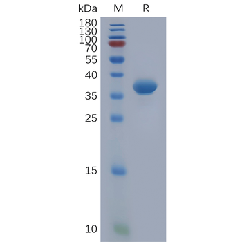 Human IL4RA Protein, His Tag