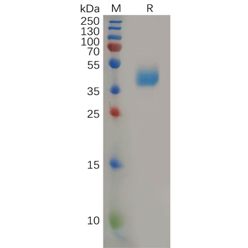 Human MUC1 Protein, hFc Tag