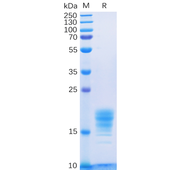 Human CB2 (1-33) Protein, hFc Tag